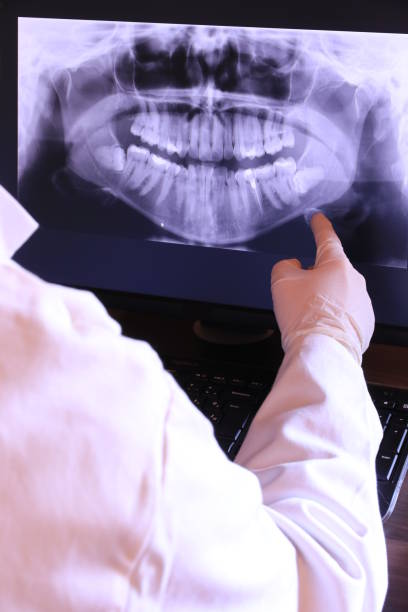 Best Emergency Dental Surgery in Brookdale, NJ