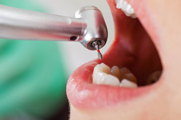Best Pediatric Emergency Dentist in Brookdale, NJ